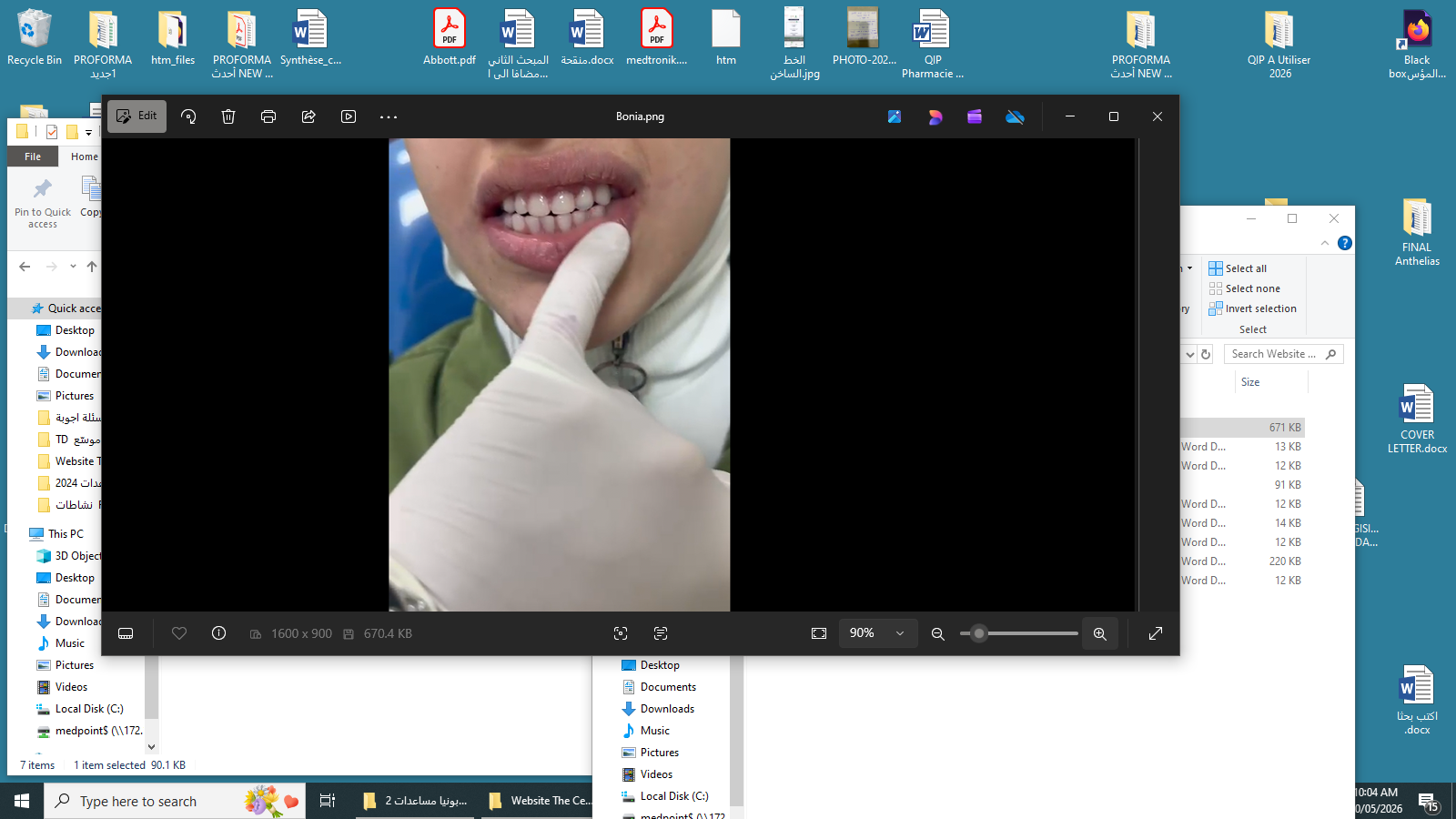 Periodontitis case after treatment